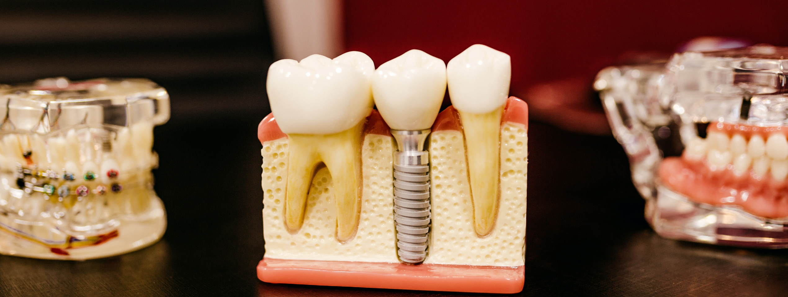 Module 1 : Dossier médical implantaire